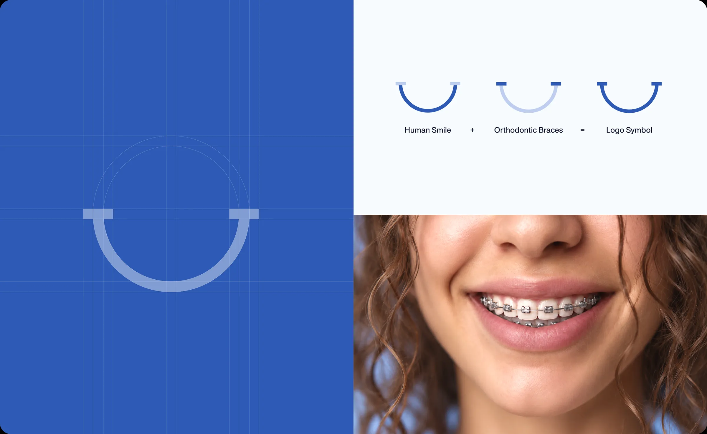 How the smile symbol was built — a human smile plus orthodontic braces — beside a patient wearing braces